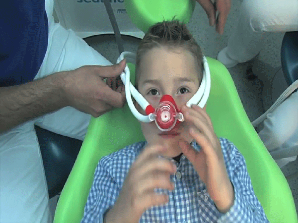 Lachgas Lachgassedatie met Biewer Medical